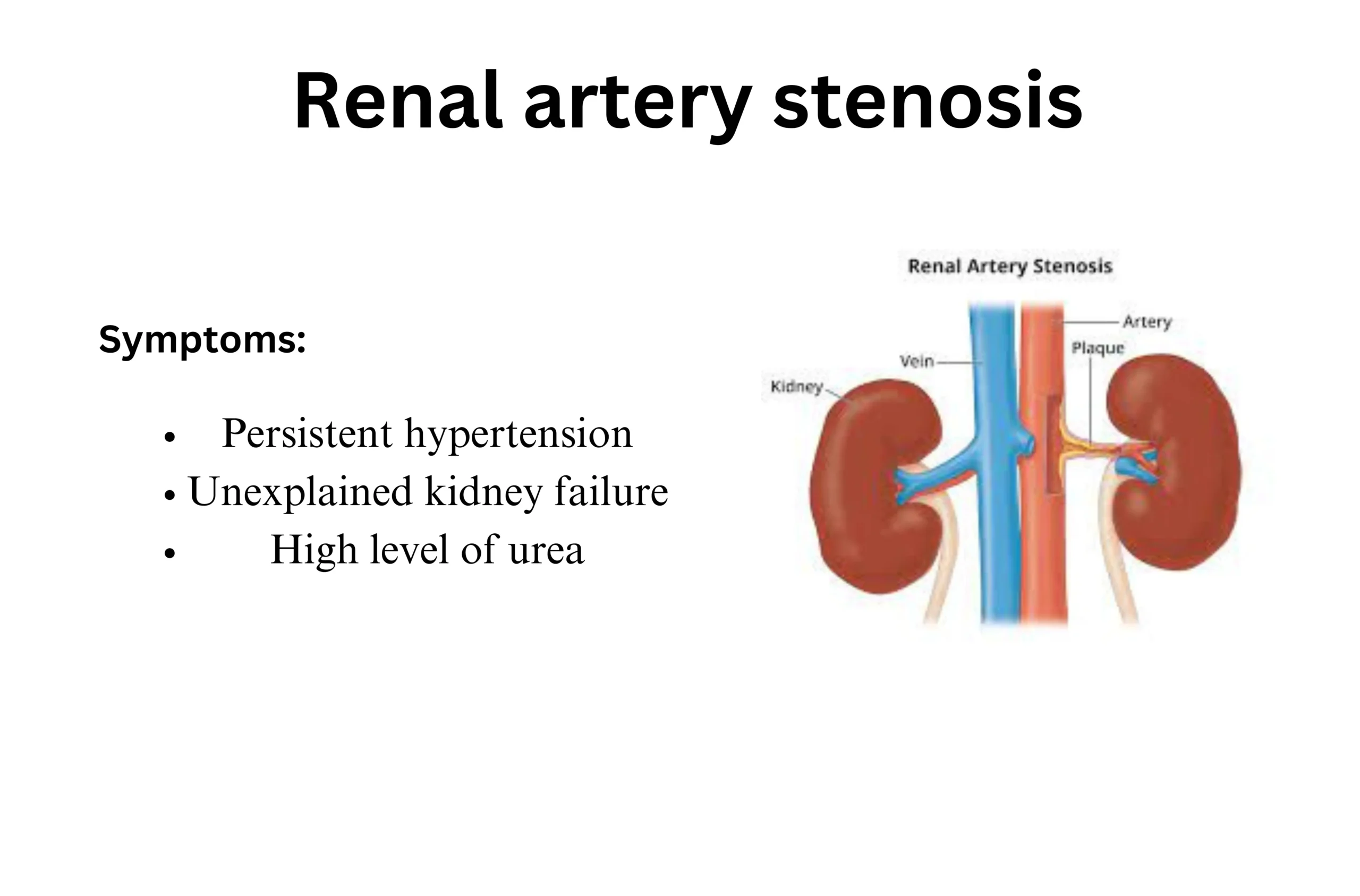 Renal artery stenosis