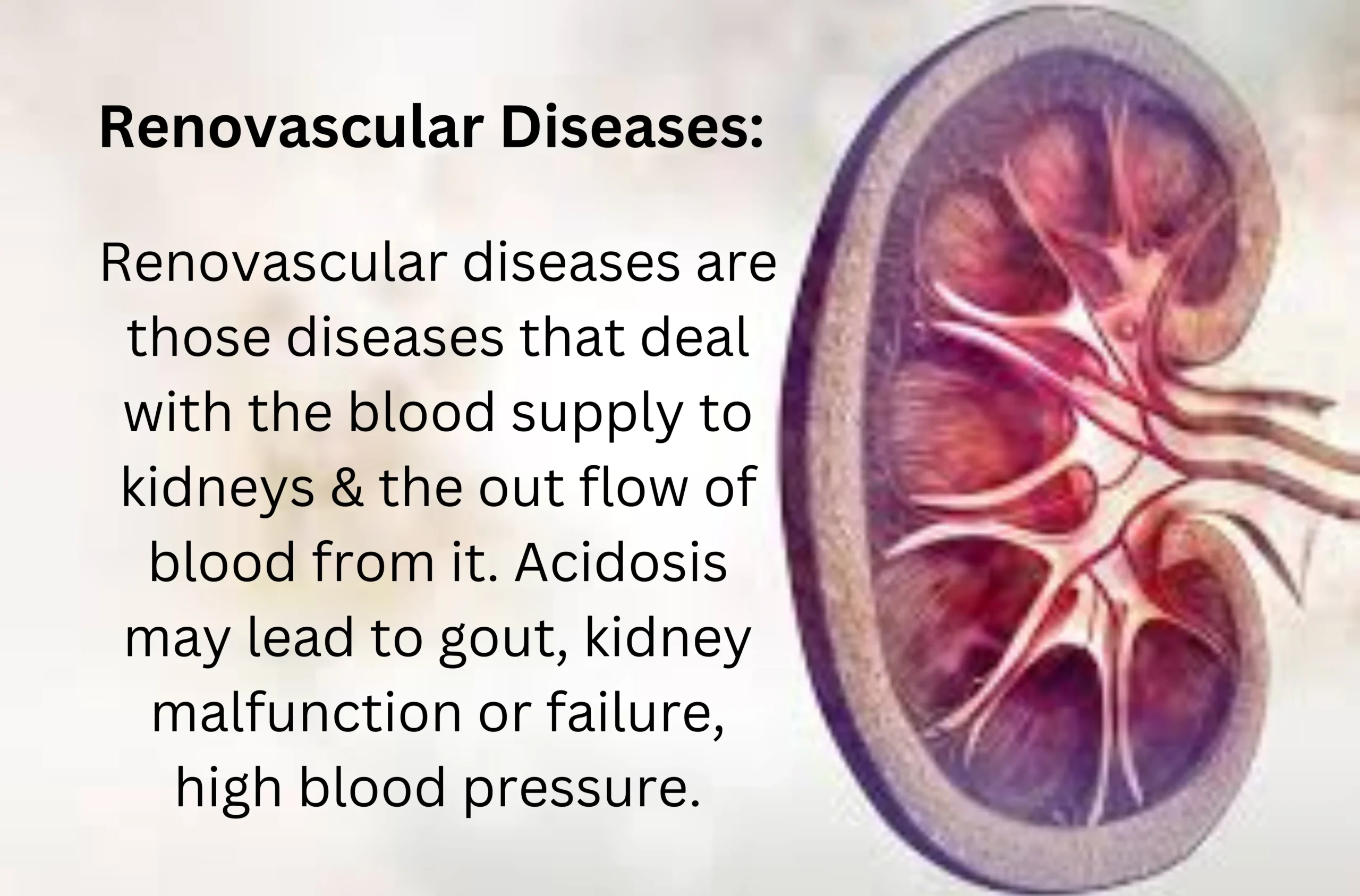 Renovascular Diseases 