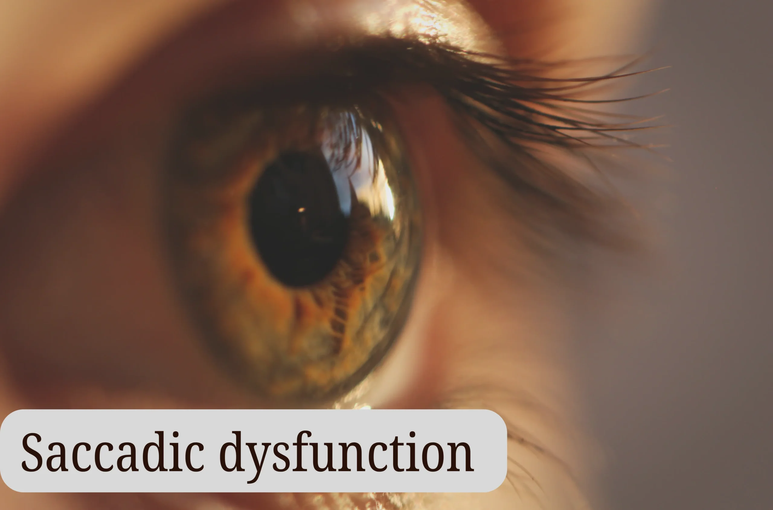 Saccadic Dysfunction