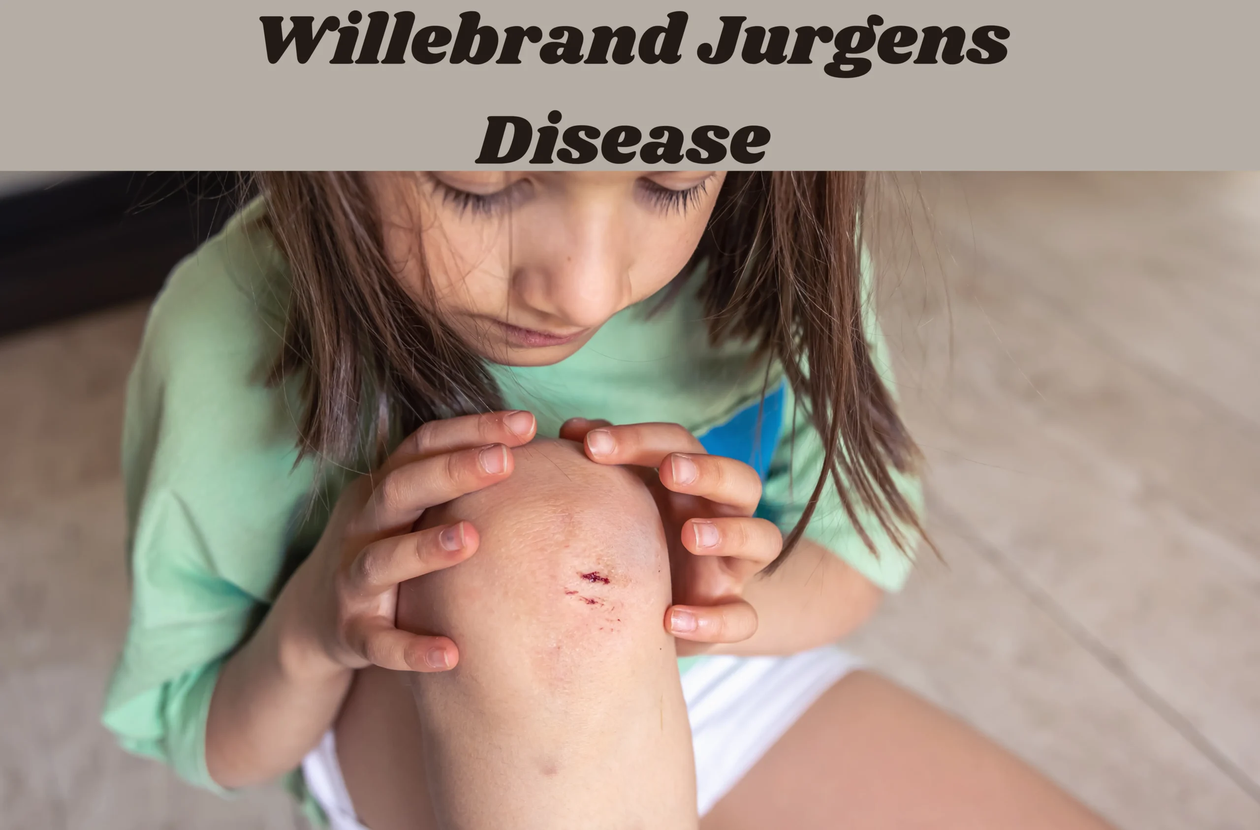 Willebrand Jurgens Disease